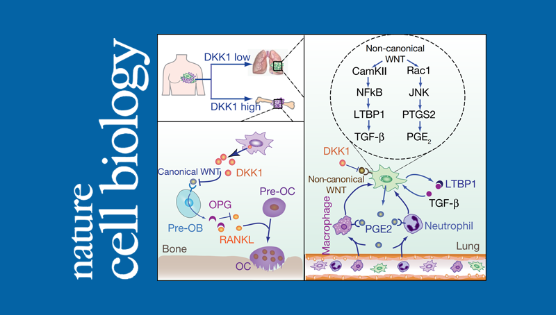 中國科學院上海營養與健康研究院研究人員在腫瘤器官特異性轉移研究中取得重要進展