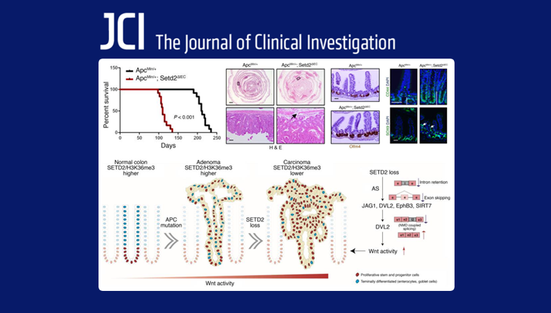 中國科學院上海營養與健康研究院科研人員揭示組蛋白H3K36三甲基轉移酶SETD2在腸癌中的重要功能及調控機制