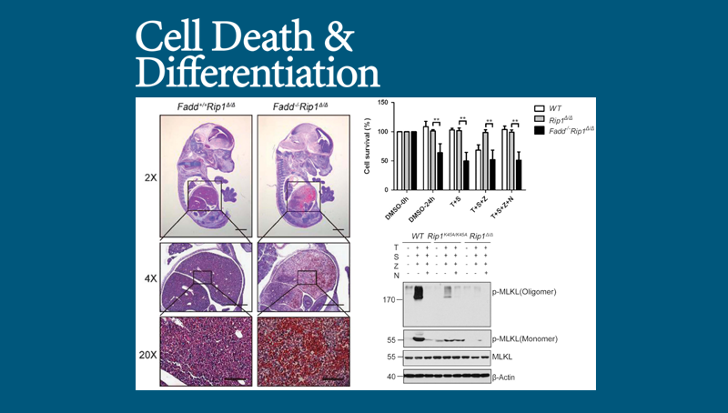 中國科學院上海營養與健康研究院科研人員揭示細胞生死的關鍵調控因子RIP1的激酶活性作用機制