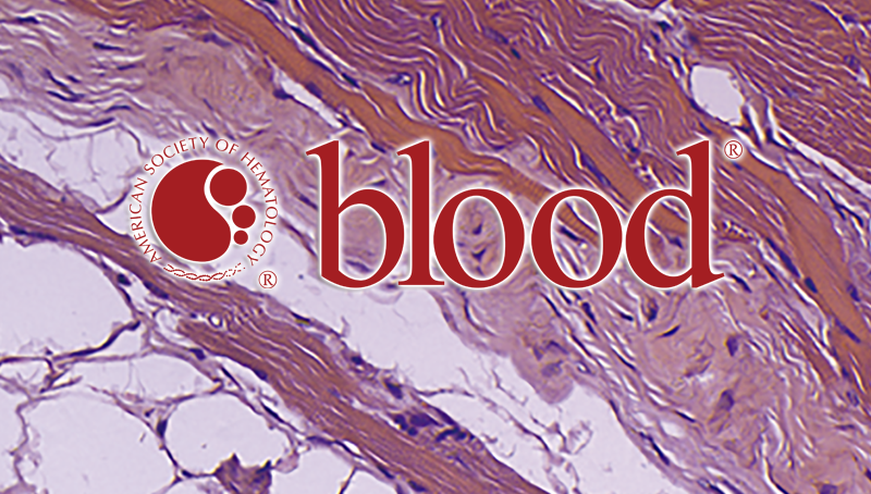 中國科學院上海營養與健康研究院科研人員揭示Hsp90調控Ezh2蛋白穩定性參與移植物抗宿主病的重要機制
