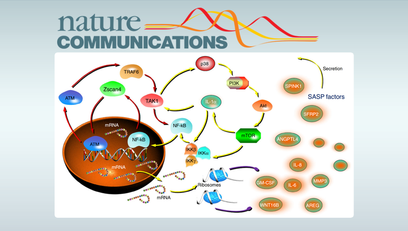 孫宇研究組揭示臨床背景下細胞衰老以及衰老相關分泌表型調控的新機制