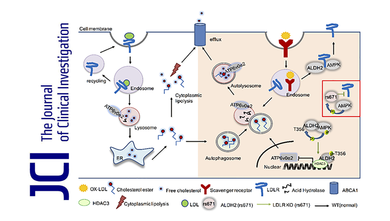 尹慧勇研究組發現乙醛脫氫酶2調控動脈粥樣硬化的新機制