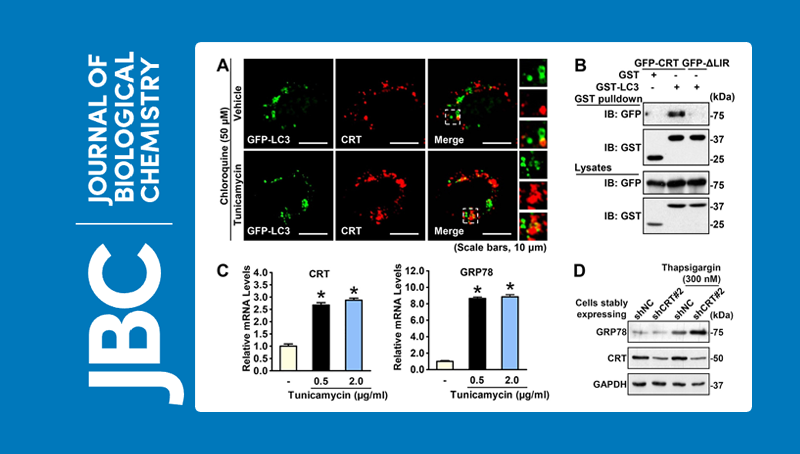 李于研究組發現關鍵內質網伴侶蛋白協同自噬途徑負反饋調節細胞應激反應的新機制