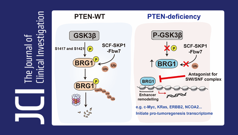 秦駿研究組發現協同致死PTEN缺失前列腺腫瘤的表觀遺傳基因