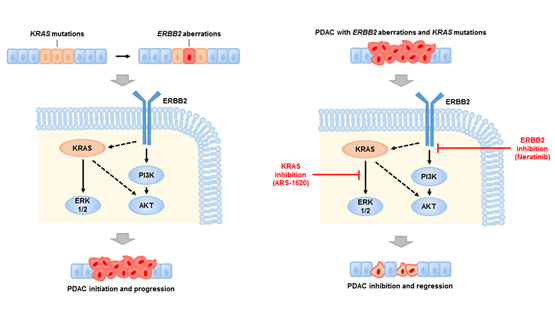 王躍祥研究組發現胰腺癌的新型治療靶點