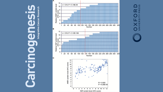 陳雁研究組合作發現多胺代謝在胃癌發生和預后中的作用