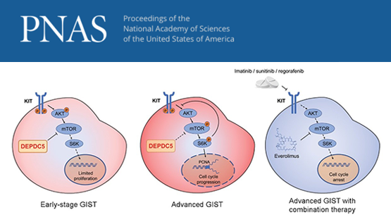 王躍祥研究組合作發現胃腸道間質瘤惡性進展的新機制