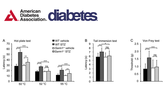 翟琦巍研究組發現防治糖尿病外周神經病變的新靶點