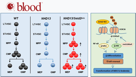 王蘭研究組揭示SETD2調(diào)控骨髓增生異常綜合征轉(zhuǎn)白血病的新機(jī)制