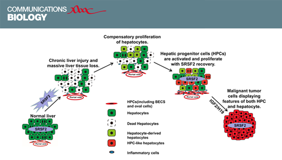 馮英研究組合作發(fā)現(xiàn)小鼠肝臟敲除SRSF2引起肝癌形成的機(jī)制