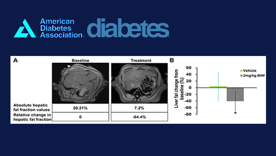 中國(guó)科學(xué)院上海營(yíng)養(yǎng)與健康研究所與天士力生物合作發(fā)表新型FGF21類(lèi)似物治療非人靈長(zhǎng)類(lèi)動(dòng)物非酒精性脂肪性肝炎的研究成果