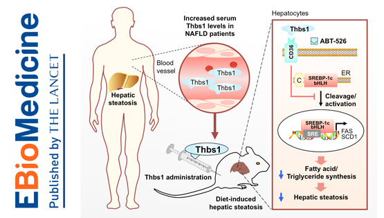 李于研究組合作發現非酒精性脂肪肝的新型生物標志物與治療靶點