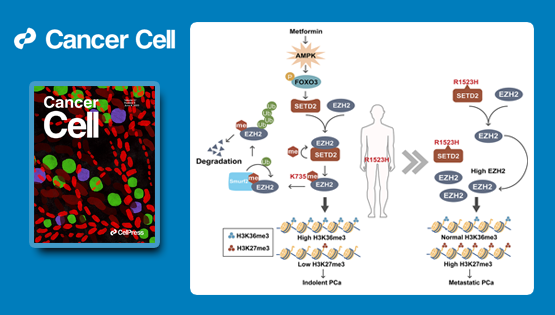 秦駿研究組等合作研究揭示前列腺癌中組蛋白H3K36三甲基轉移酶SETD2的重要功能及調控機制