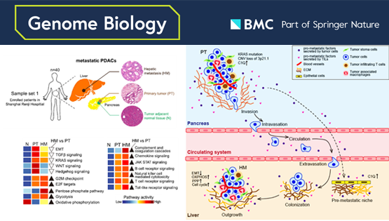 李虹、李亦學研究組合作破譯胰腺癌肝轉移的分子特征