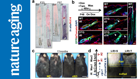營養(yǎng)與健康所張亮研究組合作發(fā)現(xiàn)皮膚上皮組織衰老的新調(diào)控機制與潛在治療標(biāo)靶
