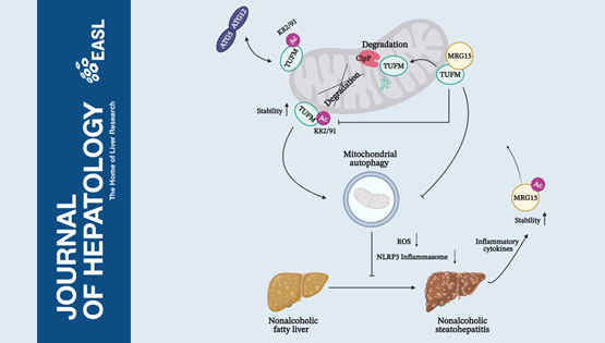營養與健康所丁秋蓉研究組發現治療非酒精性脂肪肝炎的潛在新靶點