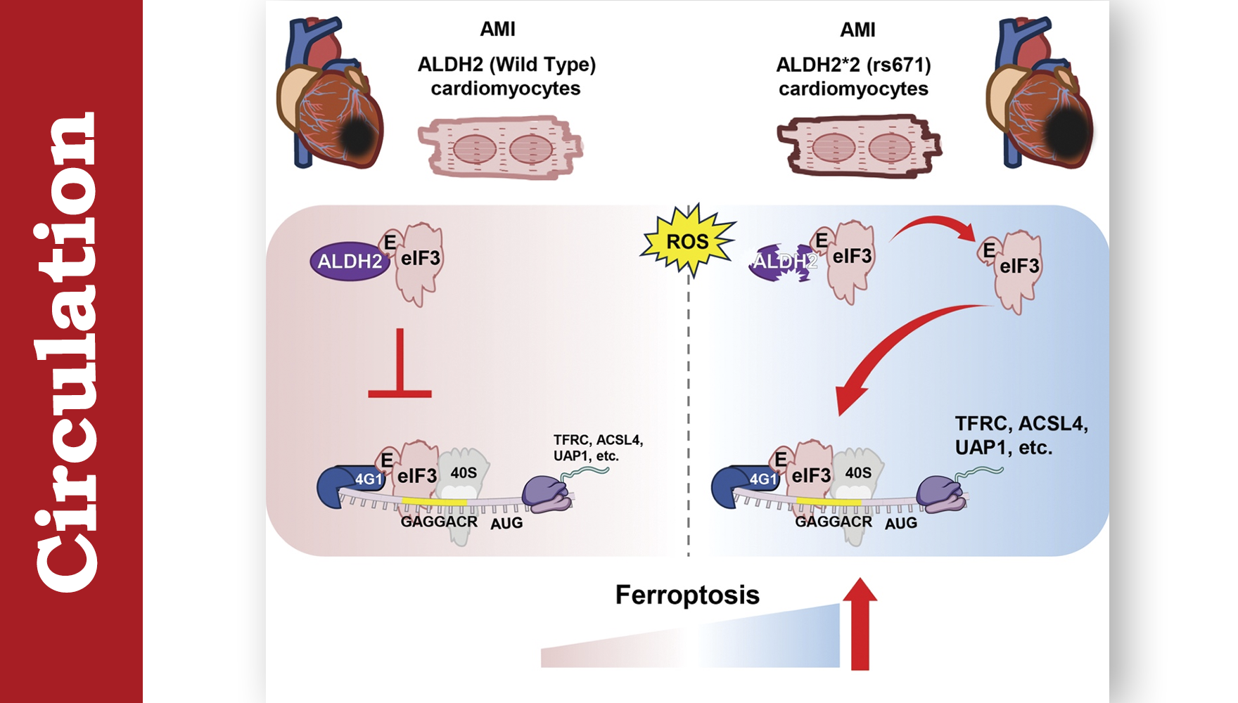 營(yíng)養(yǎng)與健康所尹慧勇團(tuán)隊(duì)合作揭示心肌梗死過(guò)程中蛋白翻譯調(diào)控心肌細(xì)胞鐵死亡機(jī)制